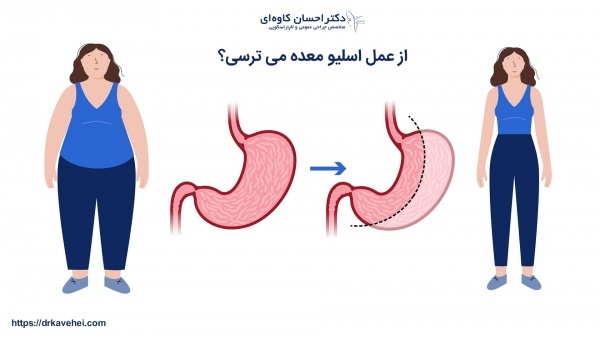 عمل لاغری، کاهش وزن بیش از 30 کیلو در کمترین زمان